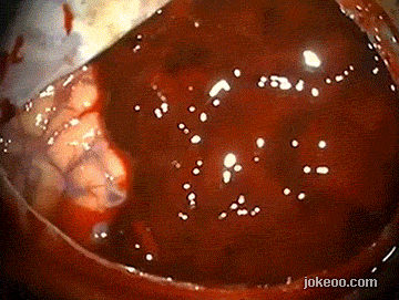 图片[5]-每日一囧 请原谅哥已经吐了，耐受力低就别进来看了 14412-囧客圈