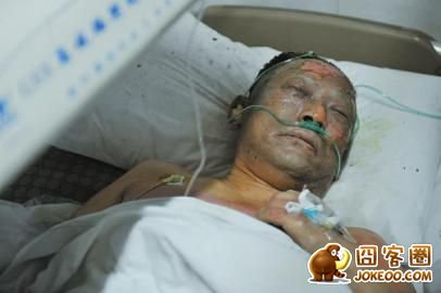 伤者刘文德在医院接受治疗。